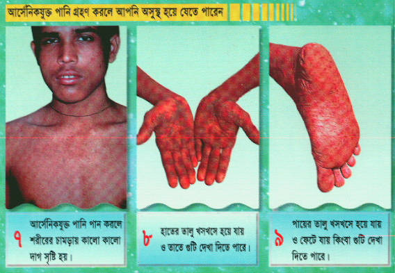 UNICEF arsenic brochure - part 3 of 5